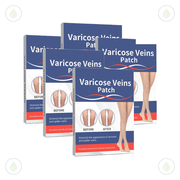Varicose